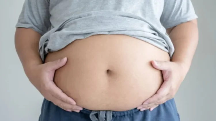Bukan Hanya karena Makan Berlebihan, Penyebab Perut Buncit yang Jarang Disadari