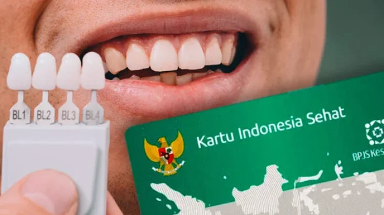 Pemeriksaan Gigi yang Ditanggung BPJS Kesehatan di Faskes Tingkat Pertama