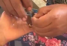 Petugas Damkar Ponorogo Bantu Evakuasi Cincin Terjepit di Jari