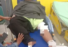 Seorang Personel Damkar Alami Luka Bakar saat Padamkan Kebakaran