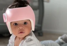 Mengenal Helm Khusus Bayi atau Helmet Therapy, Fungsi Medis atau Sekadar Gaya?