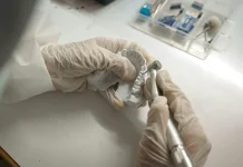 Dokter Gigi Ingatkan Pentingnya Cek Gigi Rutin Selama Enam Bulan Sekali!