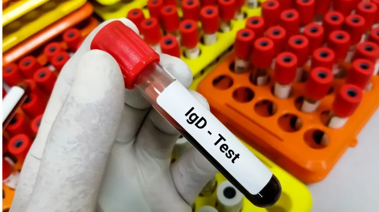 Pentingnya Diagnosis Dini Penanganan DBD di UGD