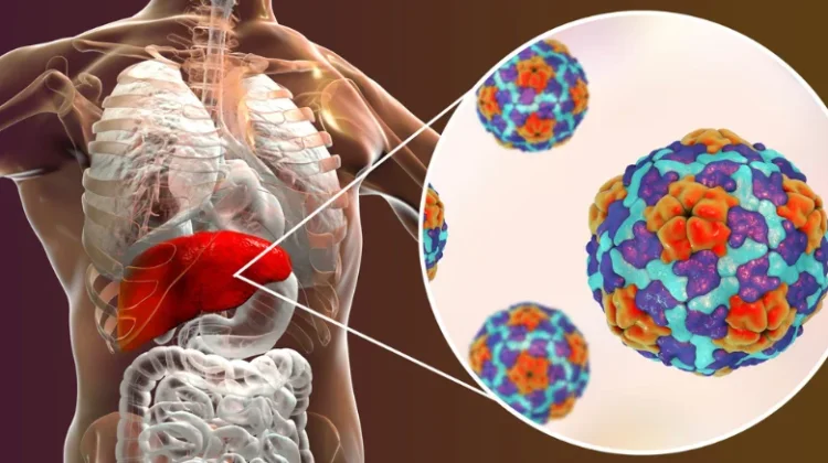 Gaya Hidup Berisiko, Generasi Muda Rentan Terkena Hepatitis