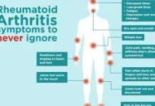Memahami Rheumatoid Arthritis: Lebih dari Sekadar Nyeri Sendi