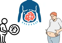 Bloating Salah Satu Penyebab Perut Terlihat Buncit