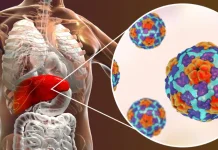 Gaya Hidup Berisiko, Generasi Muda Rentan Terkena Hepatitis