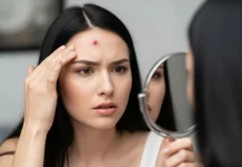 Kenali Hidradenitis Suppurativa, Benjolan Nyeri yang Bisa Kambuh