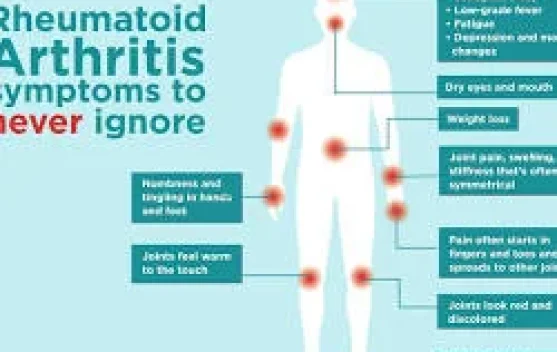 Memahami Rheumatoid Arthritis: Lebih dari Sekadar Nyeri Sendi - RRI.co.id