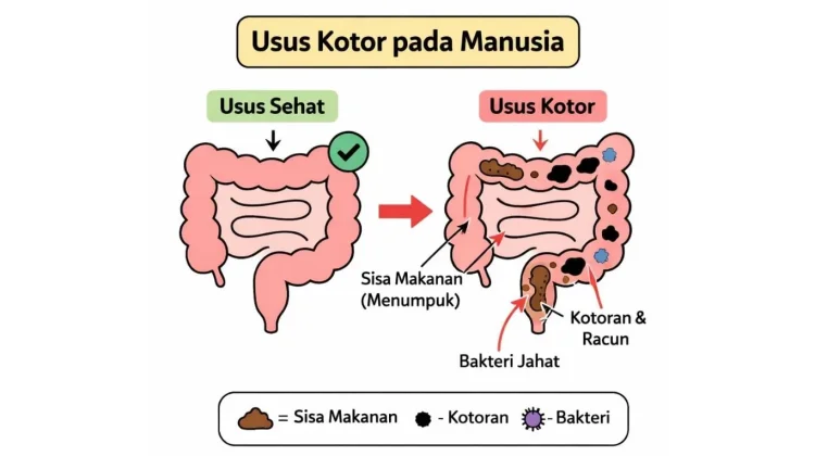 Cek Level “Kotor” Usus Selama Ramadan