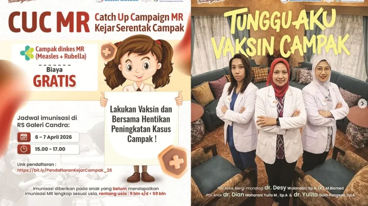 RS Galeri Candra Gelar Imunisasi Kejar Campak di Malang