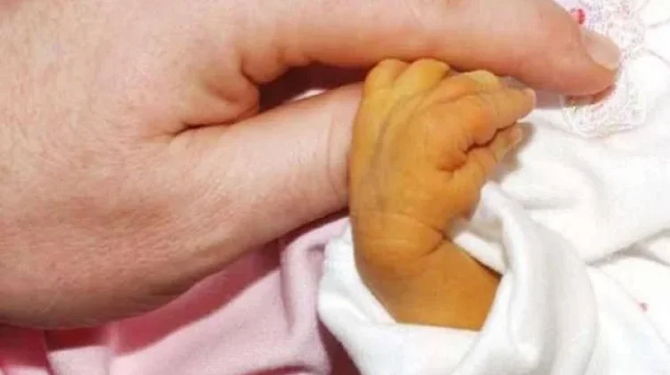 Cara Mengatasi Bayi Kuning pada Bayi Baru