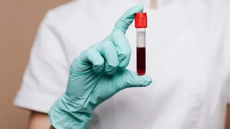 Hari Hemofilia Sedunia Dorong Kesadaran Gangguan Pembekuan Darah