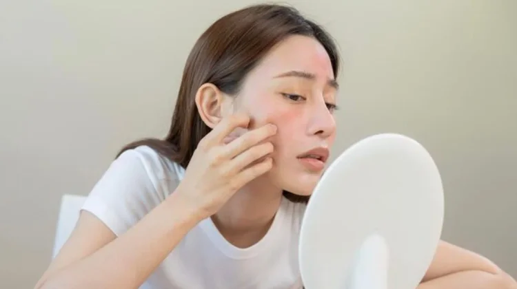 Kenali Penyebab Iritasi Kulit usai Mencoba Produk Kecantikan Baru