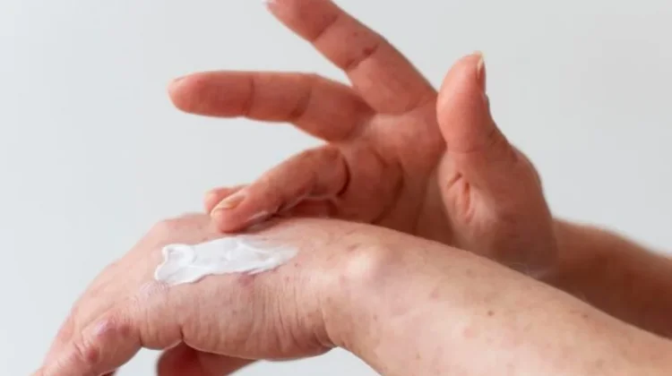 Tips Mengatasi Kulit Sensitif