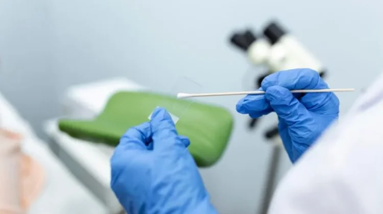 Skrining Pap Smear dalam Program JKN, Upaya Deteksi Dini Kanker Leher Rahim