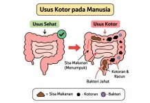 Cek Level “Kotor” Usus Selama Ramadan