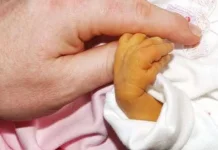 Cara Mengatasi Bayi Kuning pada Bayi Baru