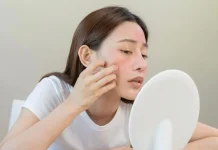 Kenali Penyebab Iritasi Kulit usai Mencoba Produk Kecantikan Baru