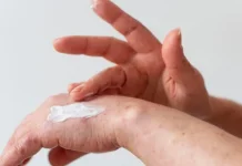 Tips Mengatasi Kulit Sensitif