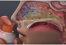 Cuci Hidung Anak Aman, Asalkan Dilakukan dengan Tepat