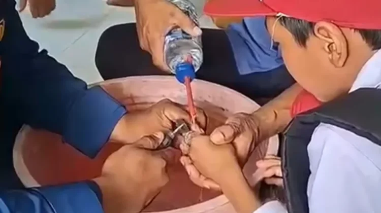 Cincin Tak Kunjung Bisa Dilepas, Siswa SD di Malinau Dievakuasi Damkar