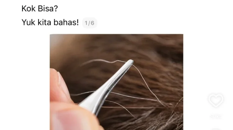 Rambut Beruban ternyata Bisa Jadi “Alarm” Tubuh? Ini Penjelasannya