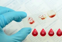 Perbedaan Setiap Golongan Darah: Kelebihan dan Kekurangannya