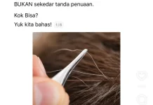 Rambut Beruban ternyata Bisa Jadi “Alarm” Tubuh? Ini Penjelasannya
