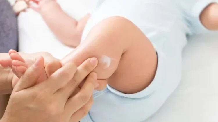 Cara Mengatasi Bisul Anak agar Tidak Semakin Parah