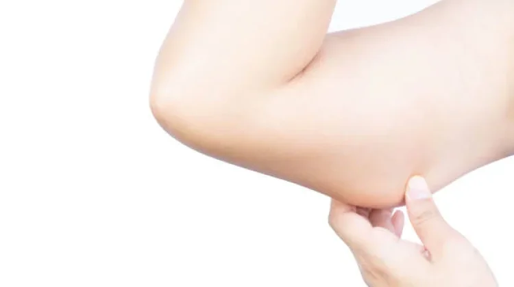 Tips Mengurangi Lemak Lengan Melalui Olahraga Rutin dan Pola Hidup Sehat