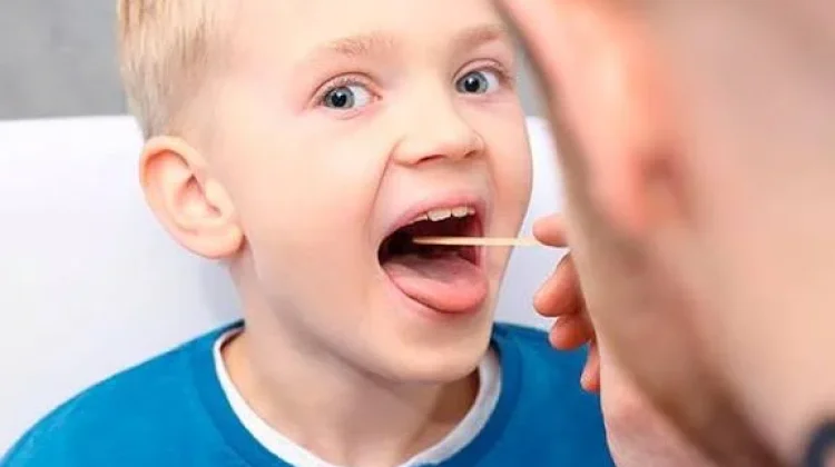 Mengenal Tonsil atau Amandel bagi Kesehatan Tubuh Manusia
