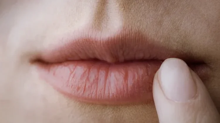 Kenali Penyebab Bibir Kering yang Sering Diabaikan
