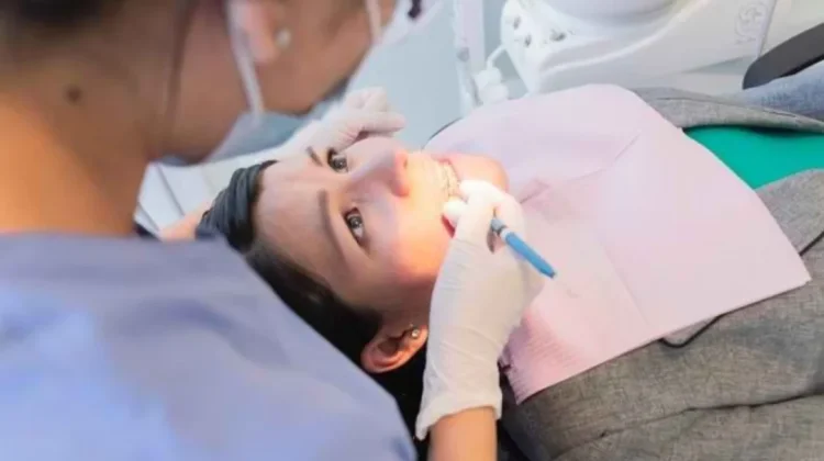 Tips Cara Membersihkan Karang Gigi