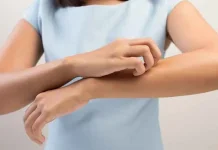 Berbagai Cara Menghilangkan Bekas Gigitan Nyamuk