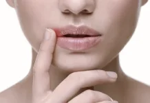 Cara Tepat Mengatasi Bibir Kering dan Pecah-Pecah
