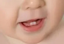 Usia Tumbuh Bayi: Kapan Gigi Muncul ?