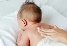 Kenali Masalah Kulit Bayi dan Cara Mengatasinya