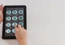 Teknologi Modern Bikin Operasi Tumor Otak Lebih Aman