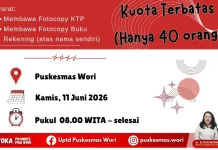 jelang Harganas, Puskesmas Wori Bakal Gelar Cabut Pasang KB Gratis