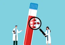 Leukemia Akut Bisa Berujung Fatal Kenali Tandanya sejak Dini