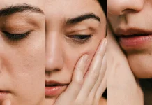 Mengenal 'Cortisol Face', Efek Nyata Stres Kronis pada Kulit