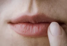 Kenali Penyebab Bibir Kering yang Sering Diabaikan