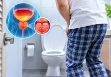 Sering Buang Air Kecil? Kenali Kaitannya dengan Prostat