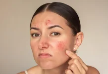Stop Gunakan Makeup yang Sudah Expired, Bisa Picu Masalah pada Kulit