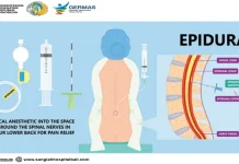Mengenal Lebih Dekat Epidural Anestesia