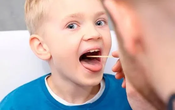 Mengenal Tonsil atau Amandel bagi Kesehatan Tubuh Manusia