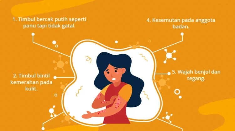 Kenali Lima Tanda Penyakit Kusta