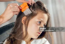 Dari Mana Datangnya Kutu di Rambut? Ini Penjelasannya
