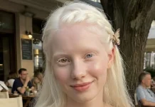 Kulit dan Rambut Putih Tak Selalu Biasa